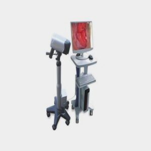 Digital Video Colposcope